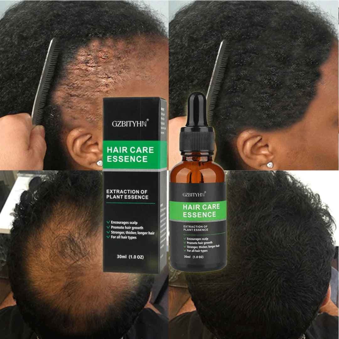 Sérum de cheveux GZBITYHN Hair Care Essence.