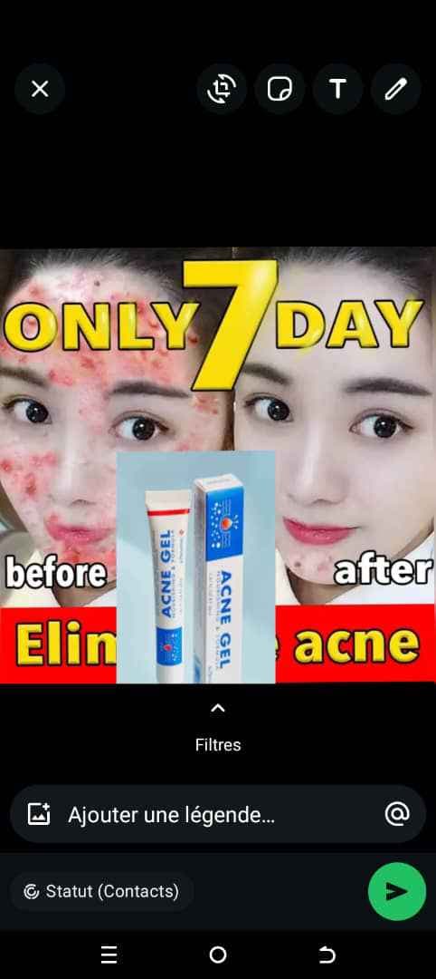 Gel acné 